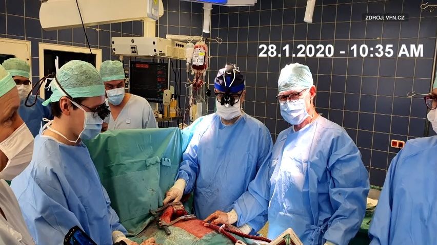 Záběry z unikátní operace: Takto čeští lékaři pověsili plíci mimo tělo